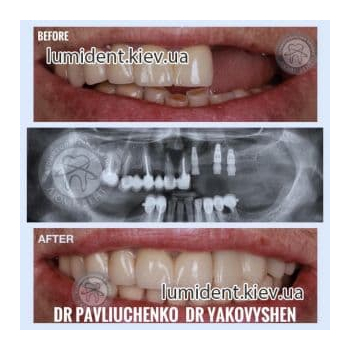 Clinical case 10