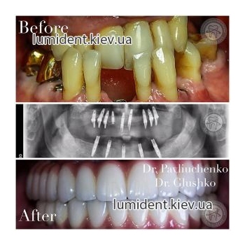 Clinical case 19