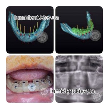 Clinical case 23