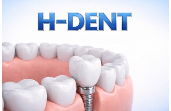Акция на установку зубных имплантов «H-Dent»