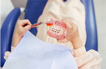 Акція на брекет систему American Orthodontics — всього 8 585 грн!
