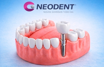 Акция на установку зубных имплантов «Neodent»