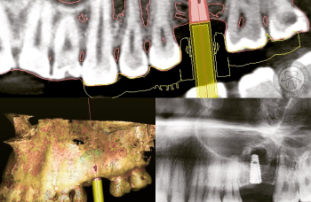 Рентгеновский снимок рентген зубов прицельный Киев фото ЛюмиДент