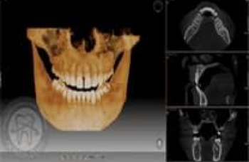 Комп'ютерна томографія щелепи верхньої нижньої Київ фото ЛюміДент