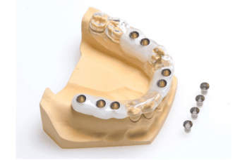 Хірургічні шаблони для імплантації зубів фото Люмі-Дент