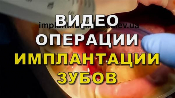 Dentistry «Lumi-Dent» in Kyiv