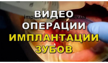 Dentistry «Lumi-Dent» in Kyiv