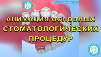 Стоматологія Люмі-Дент у Києві