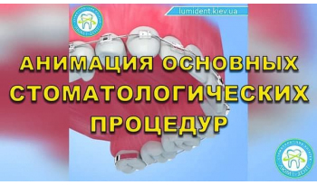 Dentistry «Lumi-Dent» in Kyiv