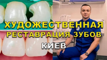 Стоматологія Люмі-Дент у Києві