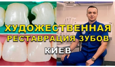 Стоматология Люми-Дент в Киеве