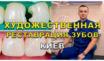 Стоматологія Люмі-Дент у Києві