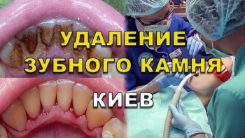 Стоматология Люми-Дент в Киеве