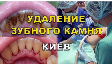 Стоматология «Люми-Дент» в Киеве