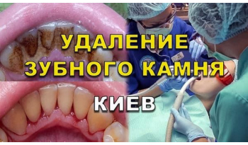 Стоматология Люми-Дент в Киеве