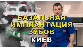 Стоматологія «Люмі-Дент» в Києві