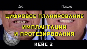 Стоматологія Люмі-Дент у Києві