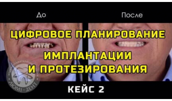 Dentistry «Lumi-Dent» in Kyiv