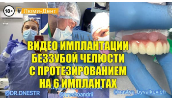 Стоматологія «Люмі-Дент» в Києві