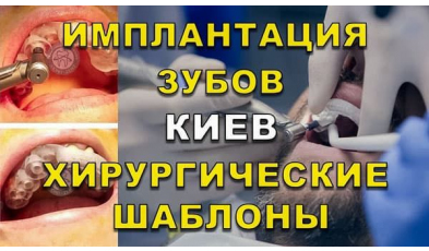 Стоматологія Люмі-Дент у Києві