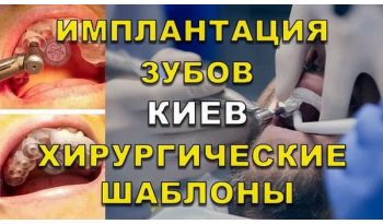 Стоматологія «Люмі-Дент» в Києві
