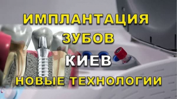 Стоматологія Люмі-Дент у Києві