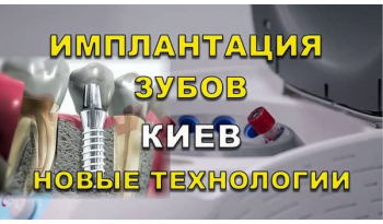 Стоматологія «Люмі-Дент» в Києві