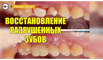Стоматологія «Люмі-Дент» в Києві
