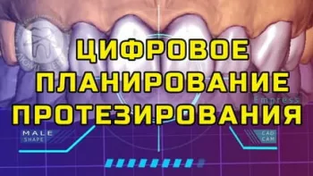 Цифра кейс 1