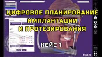 Стоматологія Люмі-Дент у Києві