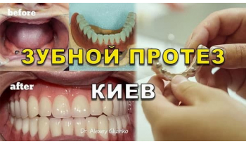 Стоматология «Люми-Дент» в Киеве