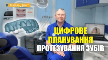 Цифровое планирование протезирования