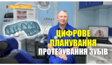 Цифровое планирование протезирования