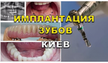 Стоматологія «Люмі-Дент» в Києві