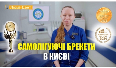 Цинцовская Оксана - видео- самолигирующие брекеты