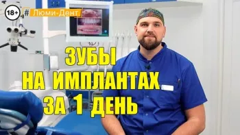 Немедленная нагрузка - Скрицкий