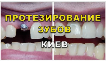 Стоматология «Люми-Дент» в Киеве